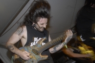VULVODYNIA